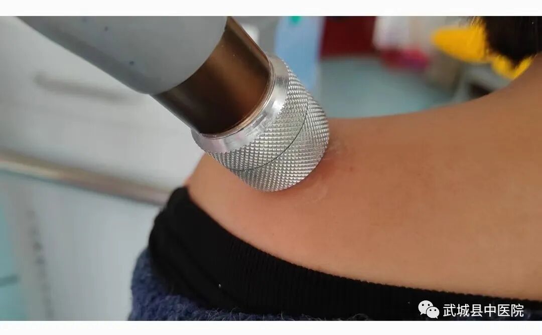 什么波治疗仪【疼痛患者福音】—冲击波疼痛治疗仪_https://www.jmylbn.com_新闻资讯_第20张