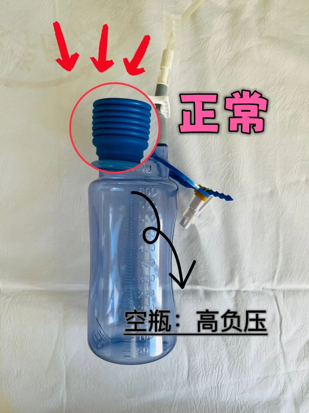 为什么负压可以引流管《 新华科普 · 乳腺健康 》第20篇  ｜ 【答疑解惑 】 术后伤口最佳护理方式在这里！_https://www.jmylbn.com_新闻资讯_第8张