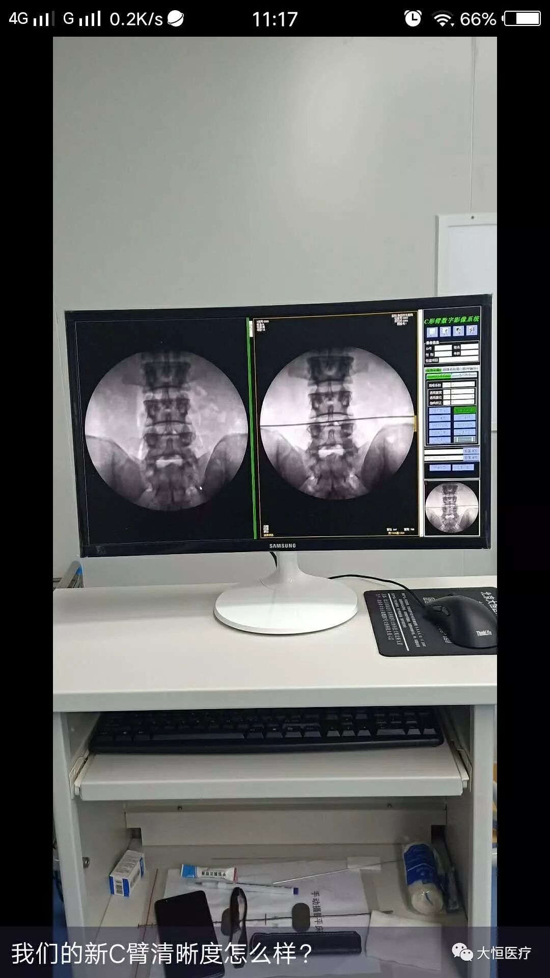 c臂怎么启动全智能型疼痛科／介入型C型臂_https://www.jmylbn.com_新闻资讯_第4张