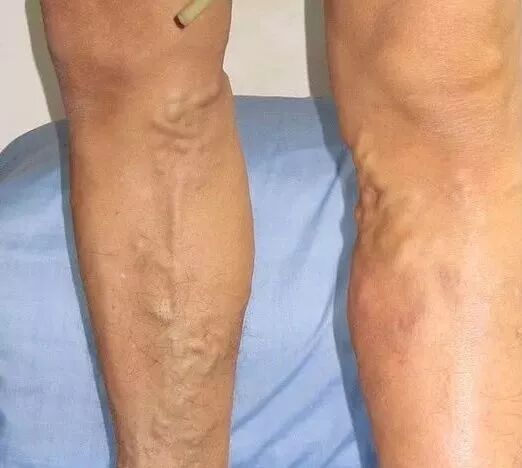 养腿＝养命！做腿的8大好处！！|养生知识-南阳宛艾产业协会