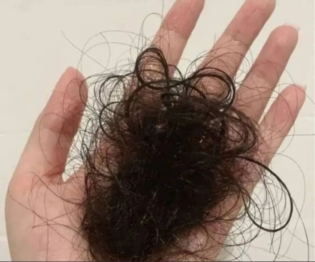 秋冬养生秋冬为何爱脱发？怎么缓解？