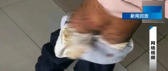 10岁女孩上课时衣服在渗血：有些人，真的不配当父母！