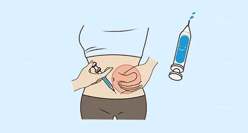 为什么20ml针筒的针在边上打完胰岛素后针尖上还有一滴药水，是注射方式不正确吗？_https://www.jmylbn.com_新闻资讯_第2张