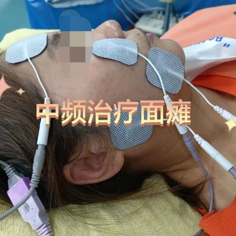 中频为什么能镇痛筋伤科：中频电治疗仪在踝关节扭伤的应用_https://www.jmylbn.com_新闻资讯_第20张