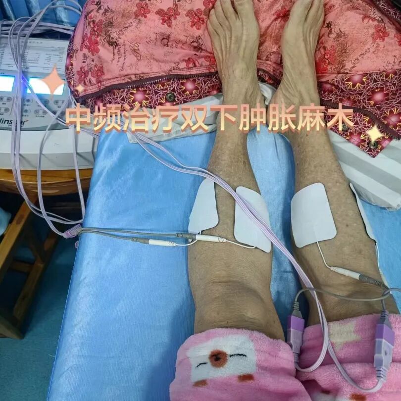 中频为什么能镇痛筋伤科：中频电治疗仪在踝关节扭伤的应用_https://www.jmylbn.com_新闻资讯_第17张