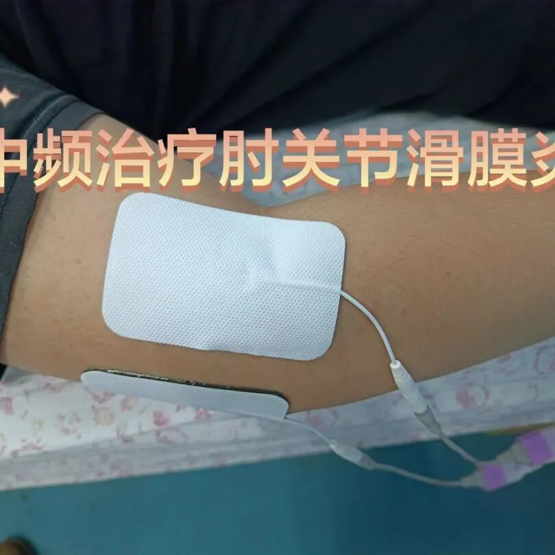 中频为什么能镇痛筋伤科：中频电治疗仪在踝关节扭伤的应用_https://www.jmylbn.com_新闻资讯_第10张