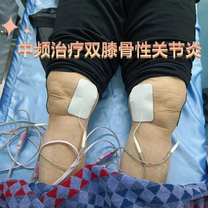 中频为什么能镇痛筋伤科：中频电治疗仪在踝关节扭伤的应用_https://www.jmylbn.com_新闻资讯_第13张