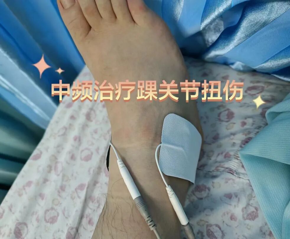 中频为什么能镇痛筋伤科：中频电治疗仪在踝关节扭伤的应用_https://www.jmylbn.com_新闻资讯_第6张