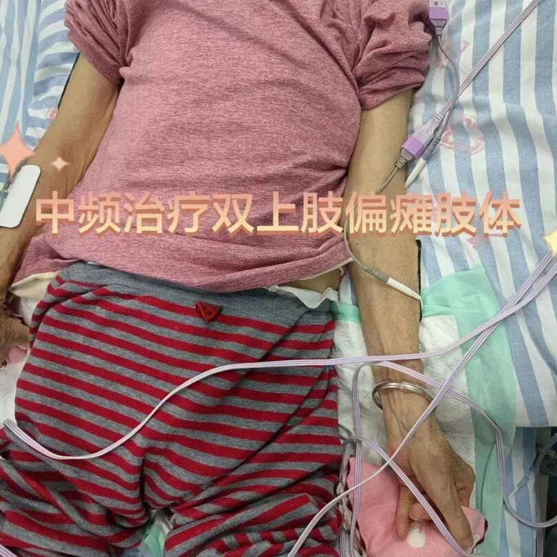 中频为什么能镇痛筋伤科：中频电治疗仪在踝关节扭伤的应用_https://www.jmylbn.com_新闻资讯_第16张