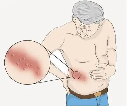 什么是臭氧大自血疗法“自血”治“自病”！阿克苏市人民医院“三氧大自血疗法”了解一下_https://www.jmylbn.com_新闻资讯_第10张