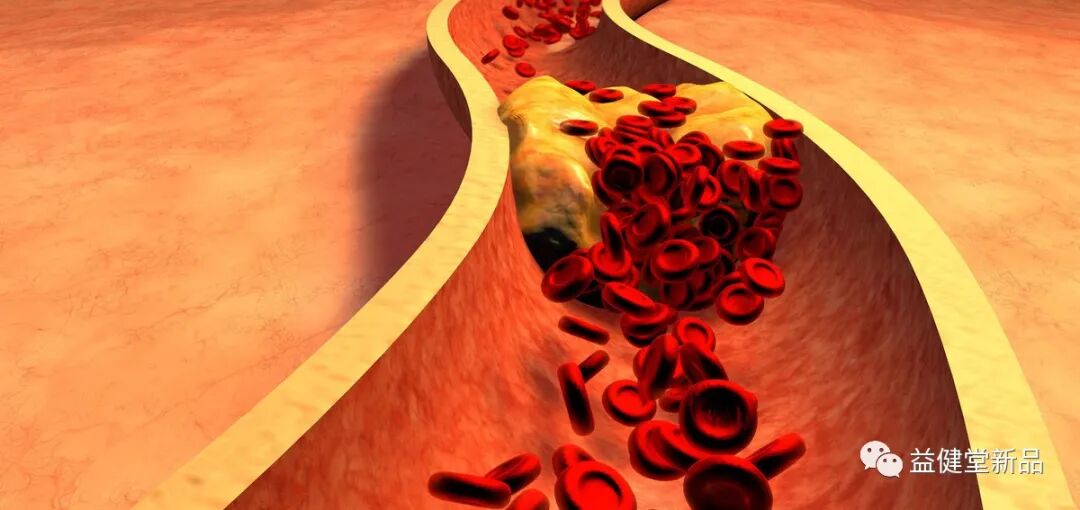 半导体激光治疗什么病​【益·新品】益健堂喜百岁 ｜ 颈部半导体激光治疗仪，2023心脑血管疾病患者的健康福音_https://www.jmylbn.com_新闻资讯_第4张