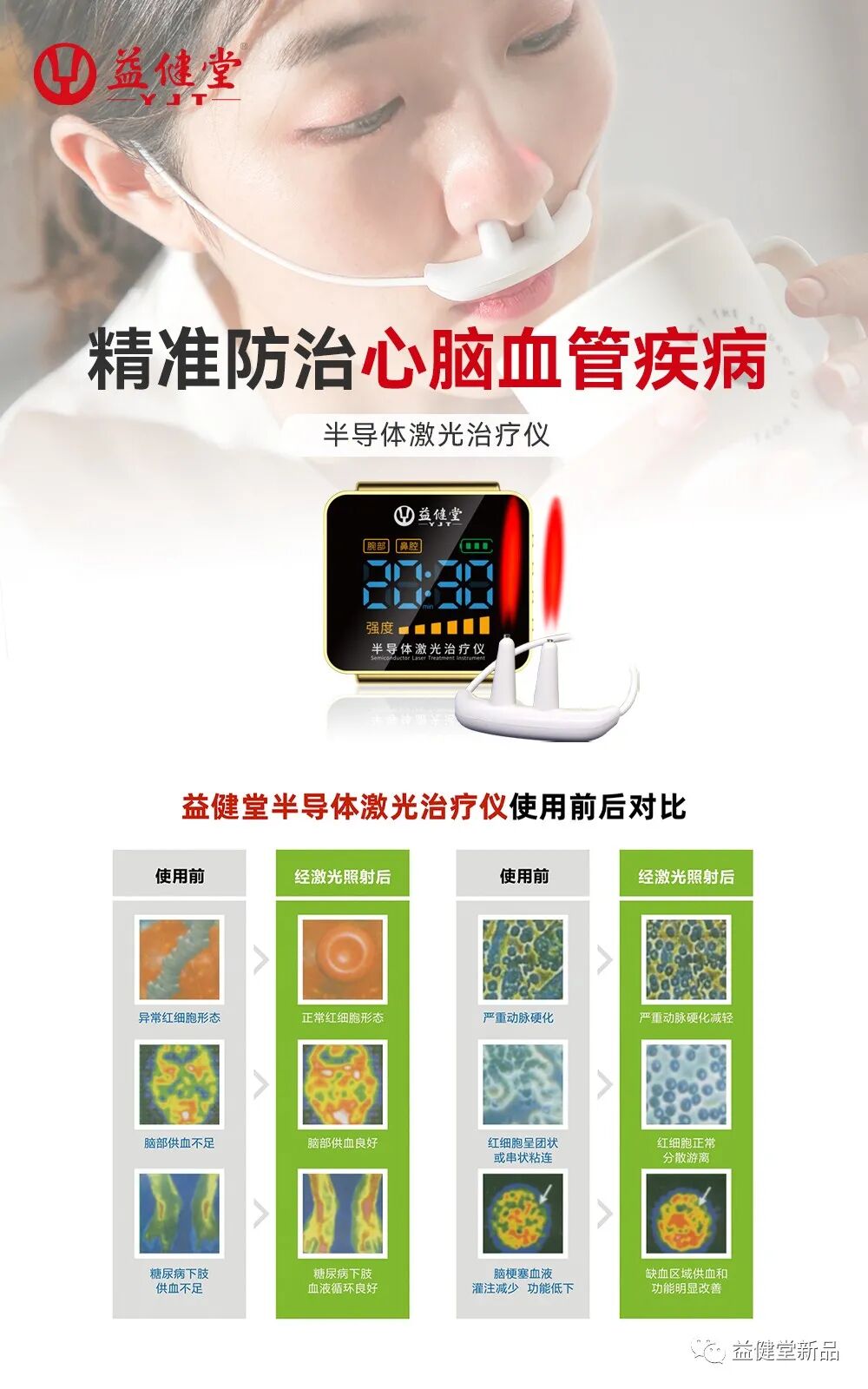 半导体激光治疗什么病【益·健康】半导体激光治疗仪照射鼻腔的作用，怎么治疗疾病？_https://www.jmylbn.com_新闻资讯_第1张