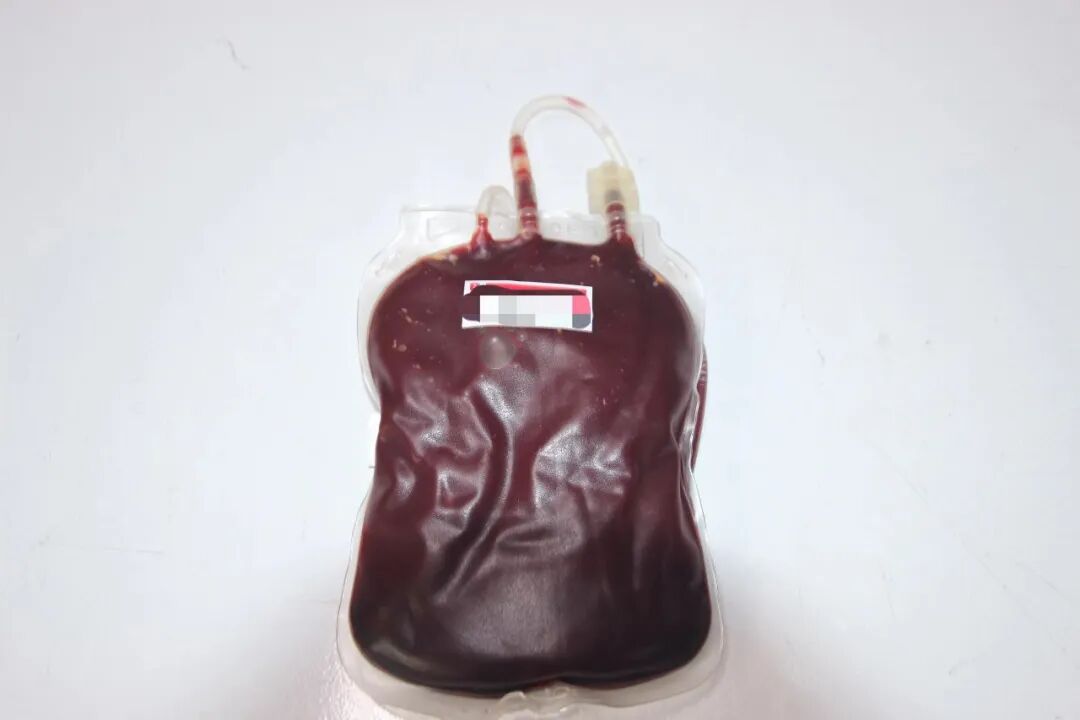 为什么一次性压脉带科普知识｜为你解答献血过程的一些疑问_https://www.jmylbn.com_新闻资讯_第2张