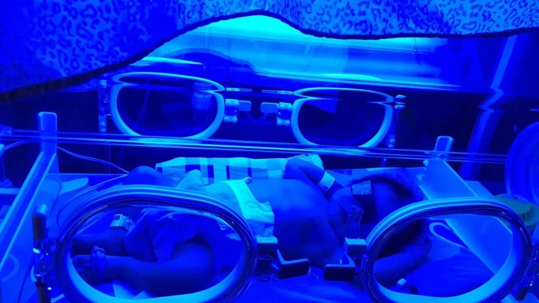 为什么要用光疗纸尿裤随治随走，“黄疸宝宝”日间光疗来啦~_https://www.jmylbn.com_新闻资讯_第7张