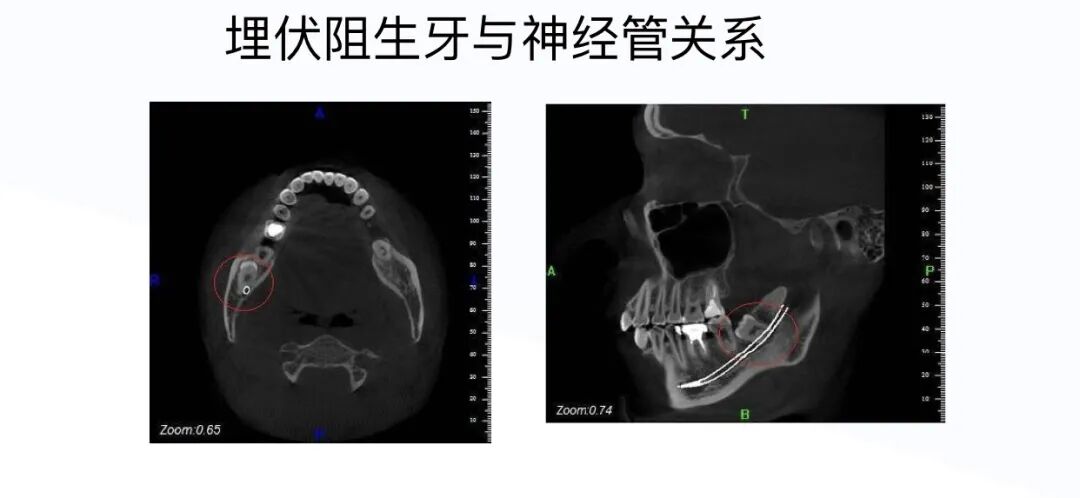 口腔ct什么牌子好“聪明可靠”的口腔全景CT来喽！赶紧上车来“瞧瞧”~_https://www.jmylbn.com_新闻资讯_第7张