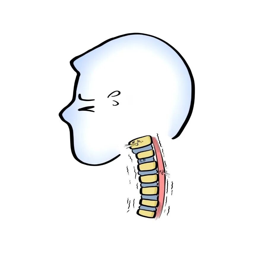是手机玩太多的锅吗?-友友