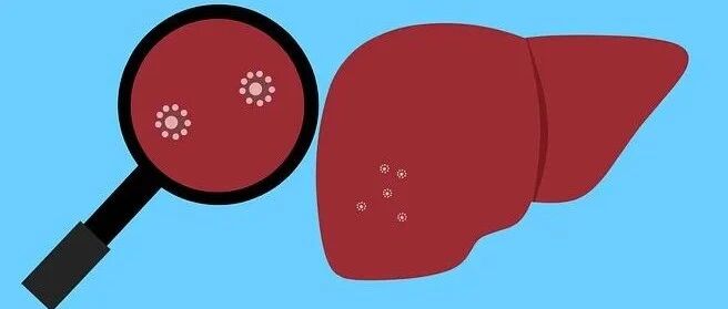 女子肝脏被“吃”三分之一，凶手竟是一条“鱼”？