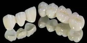 全瓷牙的“保质期”及其七大优势