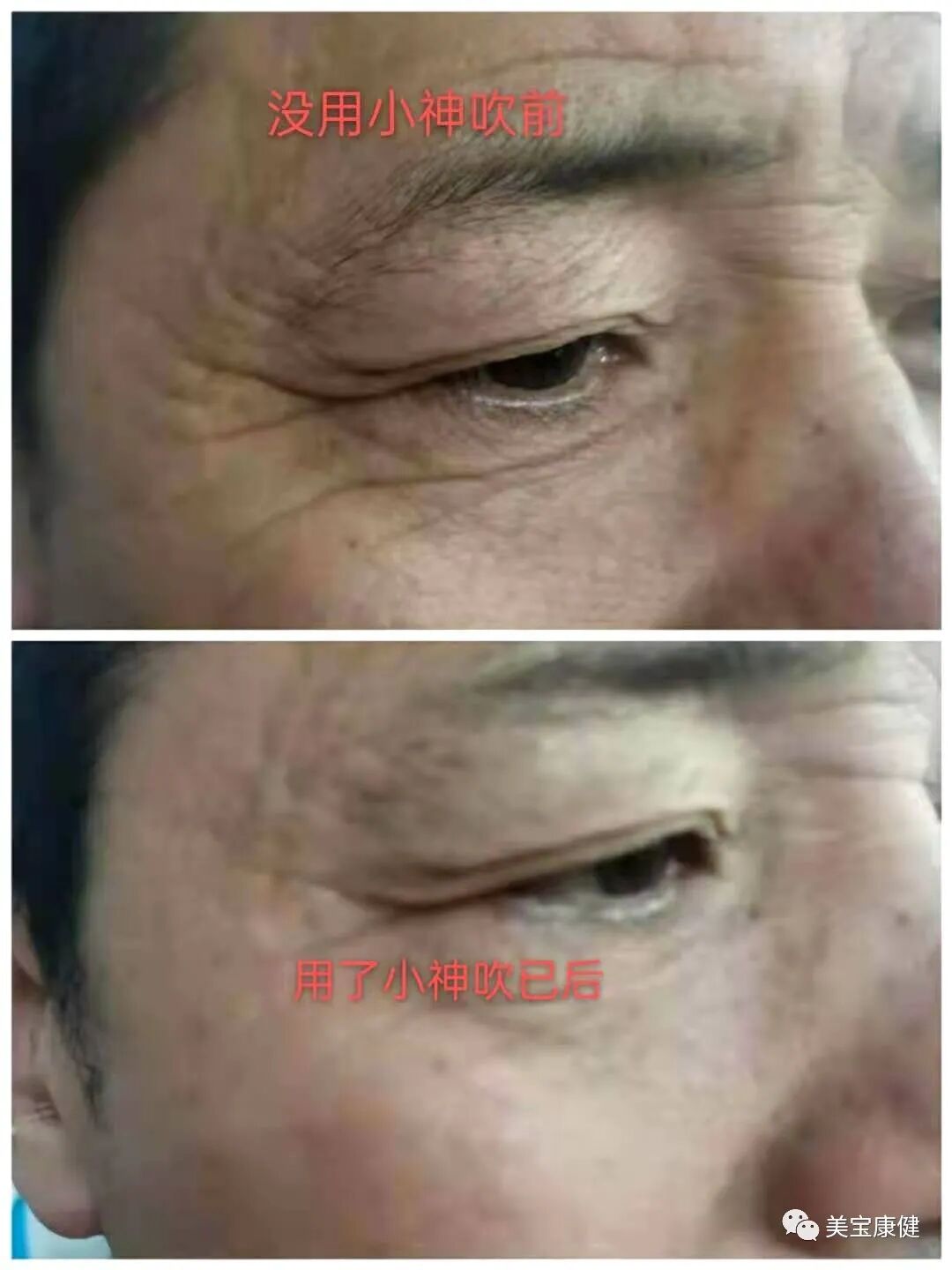 小神吹为什么这么火