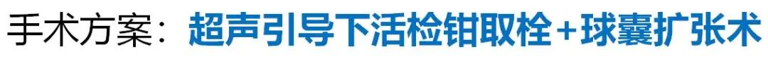 活检钳怎么用医技丨微创引领血管通路新时代，活检钳在自体动静脉内瘘血栓形成中的应用_https://www.jmylbn.com_新闻资讯_第8张