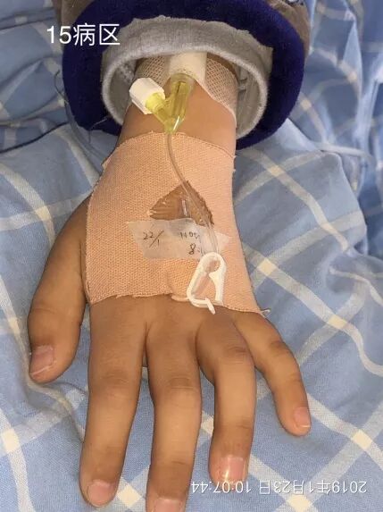 普通留置针怎么固定小儿留置针容易滑脱，这样固定安全又有爱！_https://www.jmylbn.com_新闻资讯_第2张