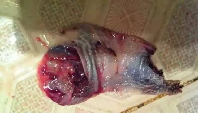 妇科清洗器怎么使用全新升级款：关爱女性健康--给我们子宫洗个澡-成就家庭幸福-女性私密抗衰宝贝-旗黄妇女用抑菌粉（妇洁宝：轻松解决妇科问题）_https://www.jmylbn.com_新闻资讯_第6张