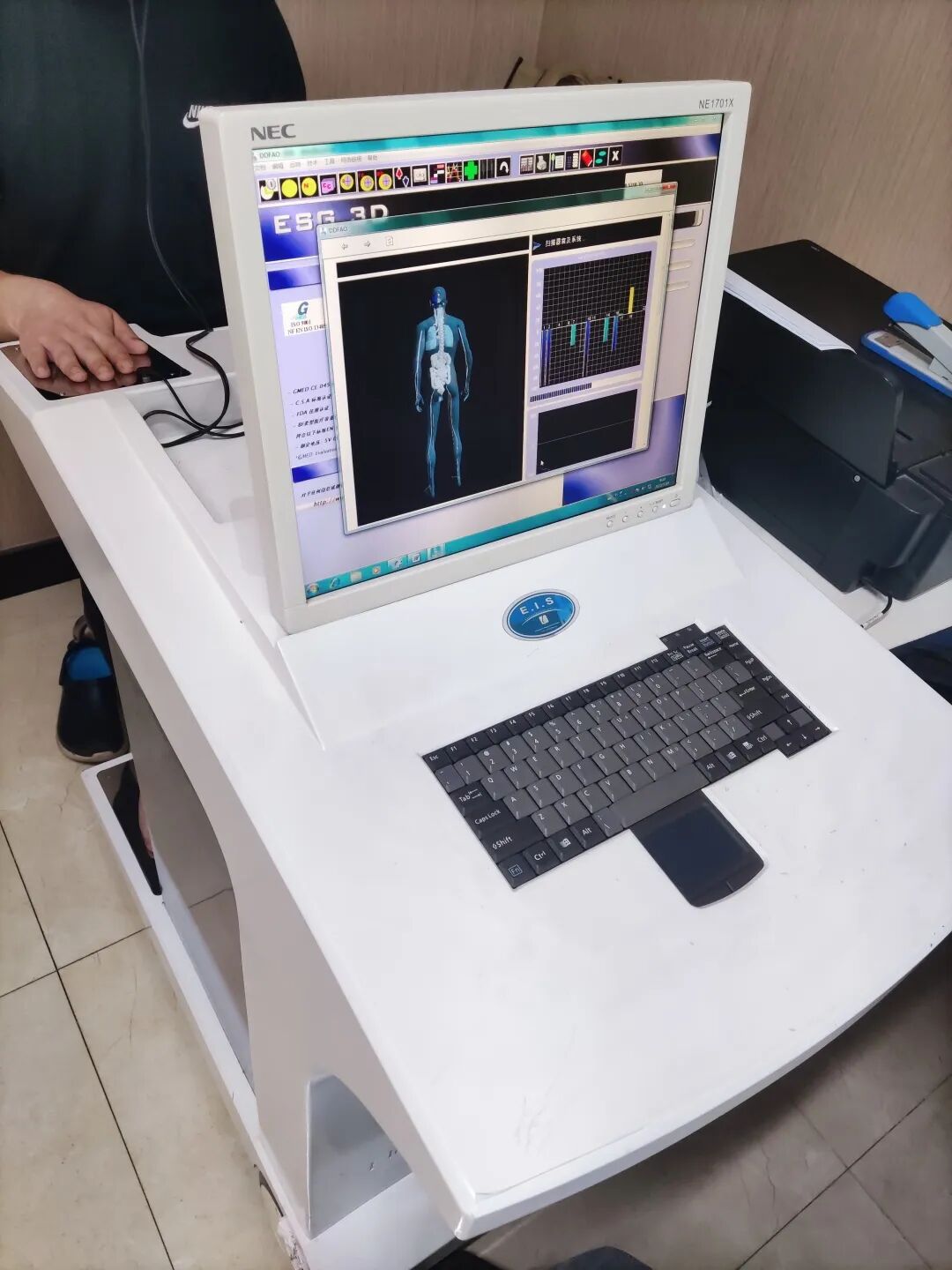 法国鹰演怎么查法国鹰演全身健康扫描系统，全身疾病早知道_https://www.jmylbn.com_新闻资讯_第3张