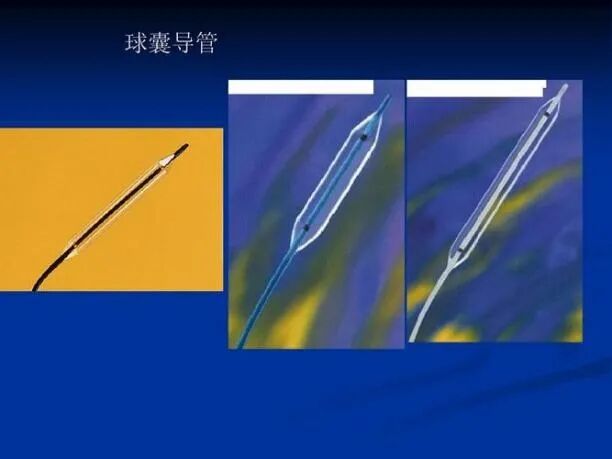 医疗耗材做什么好原创科普好文｜医疗耗材兵器谱之介入球囊_https://www.jmylbn.com_新闻资讯_第14张