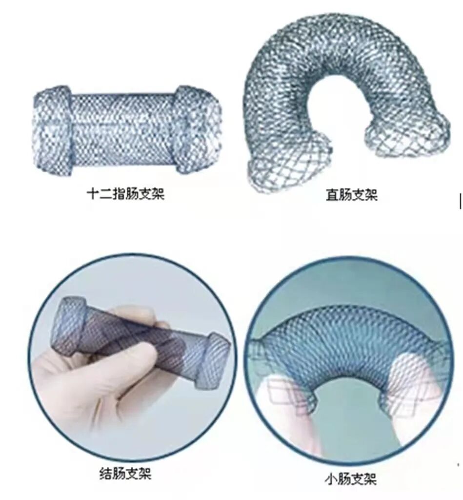 什么是介入耗材原创｜医疗耗材兵器谱之介入支架_https://www.jmylbn.com_新闻资讯_第41张