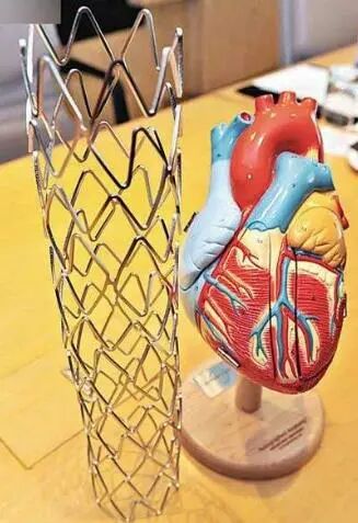 什么是介入耗材原创｜医疗耗材兵器谱之介入支架_https://www.jmylbn.com_新闻资讯_第32张