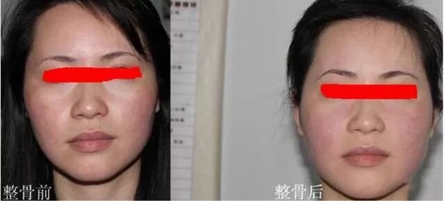 徒手整形 是高科技还是 智商税 医美大平台 微信公众号文章阅读 Wemp