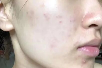 能肉眼螨虫看到的东西_螨虫肉眼能看到吗_能肉眼螨虫看到吗