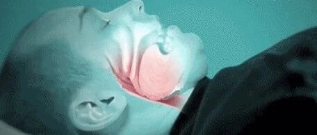 一晚上呼吸暂停300多次！他拖了3年才就医！快“唤醒”你的枕边人