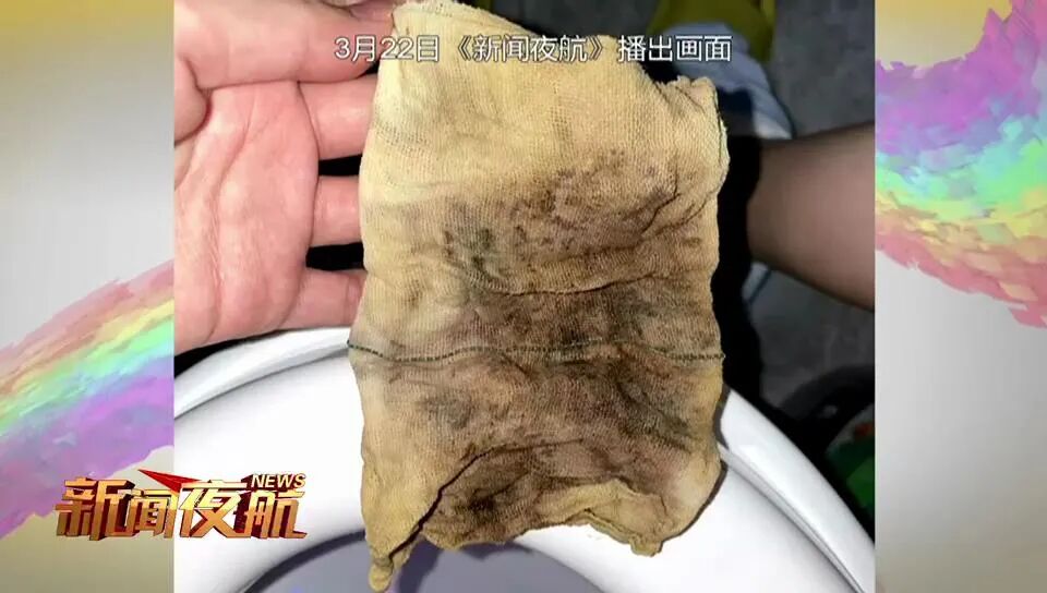 纱块怎么利用哈尔滨女子产后腹痛！竟拽出一块纱布！已发黑……_https://www.jmylbn.com_新闻资讯_第1张