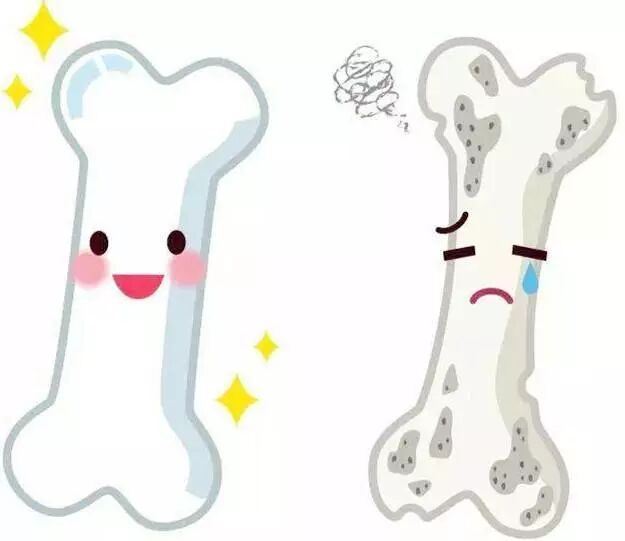 骨密度oi值代表什么OI大讲堂 ｜ 骨密度：什么是骨密度？如何测量？（上）_https://www.jmylbn.com_新闻资讯_第2张