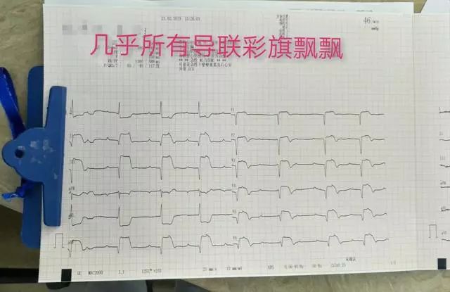 熱水澡泡出