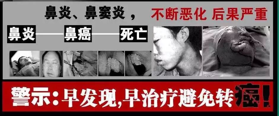 【鼻腔·养护】鼻炎的七大并发症！！！