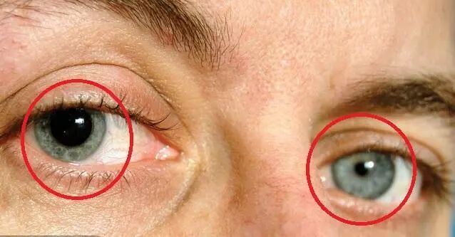 身体出问题 眼睛会发信号 医生提醒 这几种眼部症状早查 别拖 健康问上医 微文库