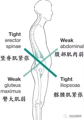 腰肌劳损，腹部无力？这6个经典的动作要常练！（附动图）