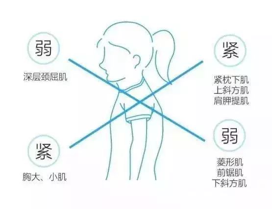 4组理疗串联序列，调整上交叉综合征超级有效！