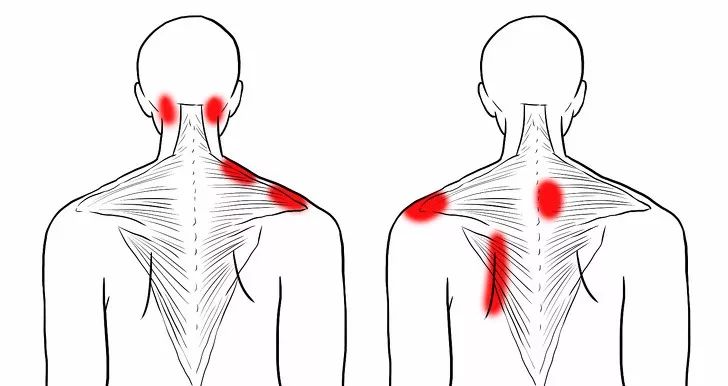 10张精准拉伸解剖图，“肩颈疼痛”这样练就对了！