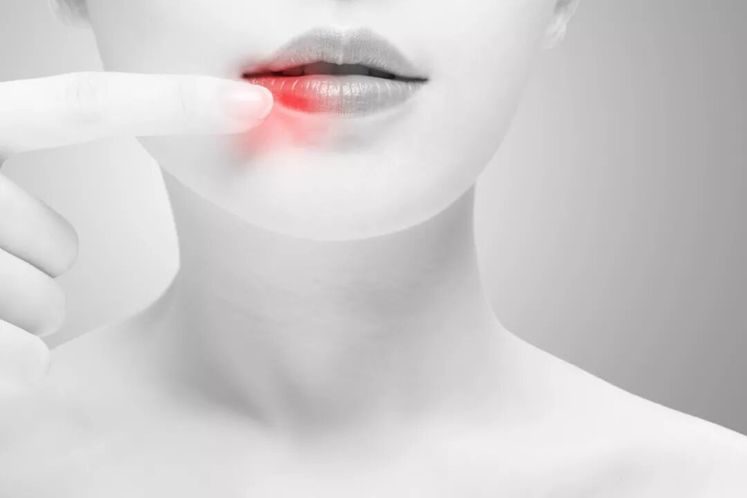 艾艾贴 嘴唇干裂脱皮怎么办 不懂这些 抹再多唇膏都不管用 艾艾贴资讯 艾艾贴 艾艾贴加盟代理 深圳前海艾艾贴总代理林华燕