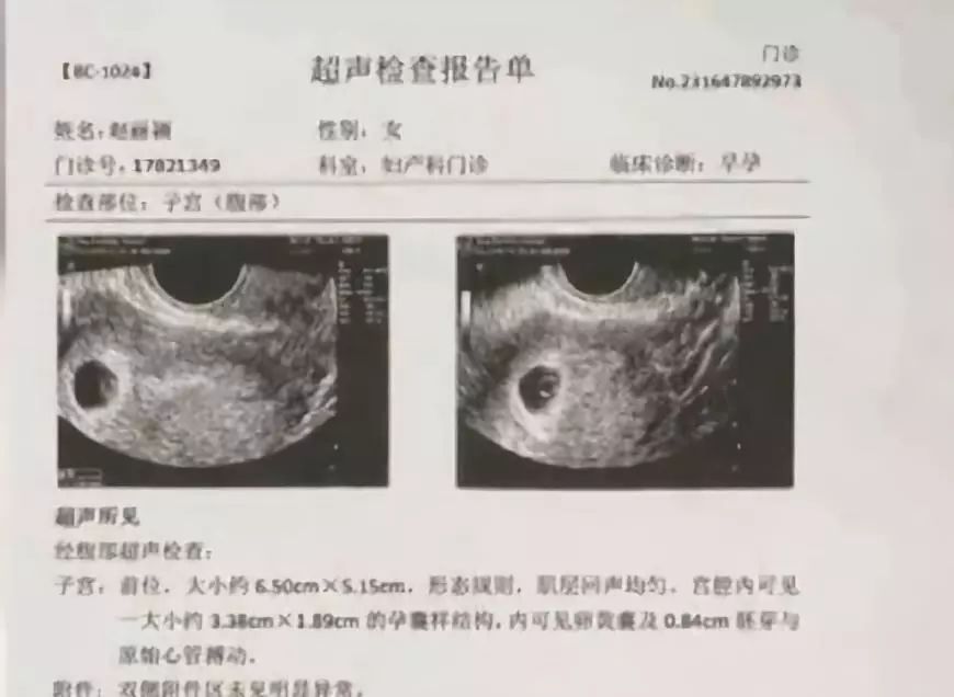 網曝趙麗穎懷孕！預產期在明年三月份！產檢報告疑似曝光證實傳聞！曬素顏自拍大炫婚戒？ 娛樂 第23張