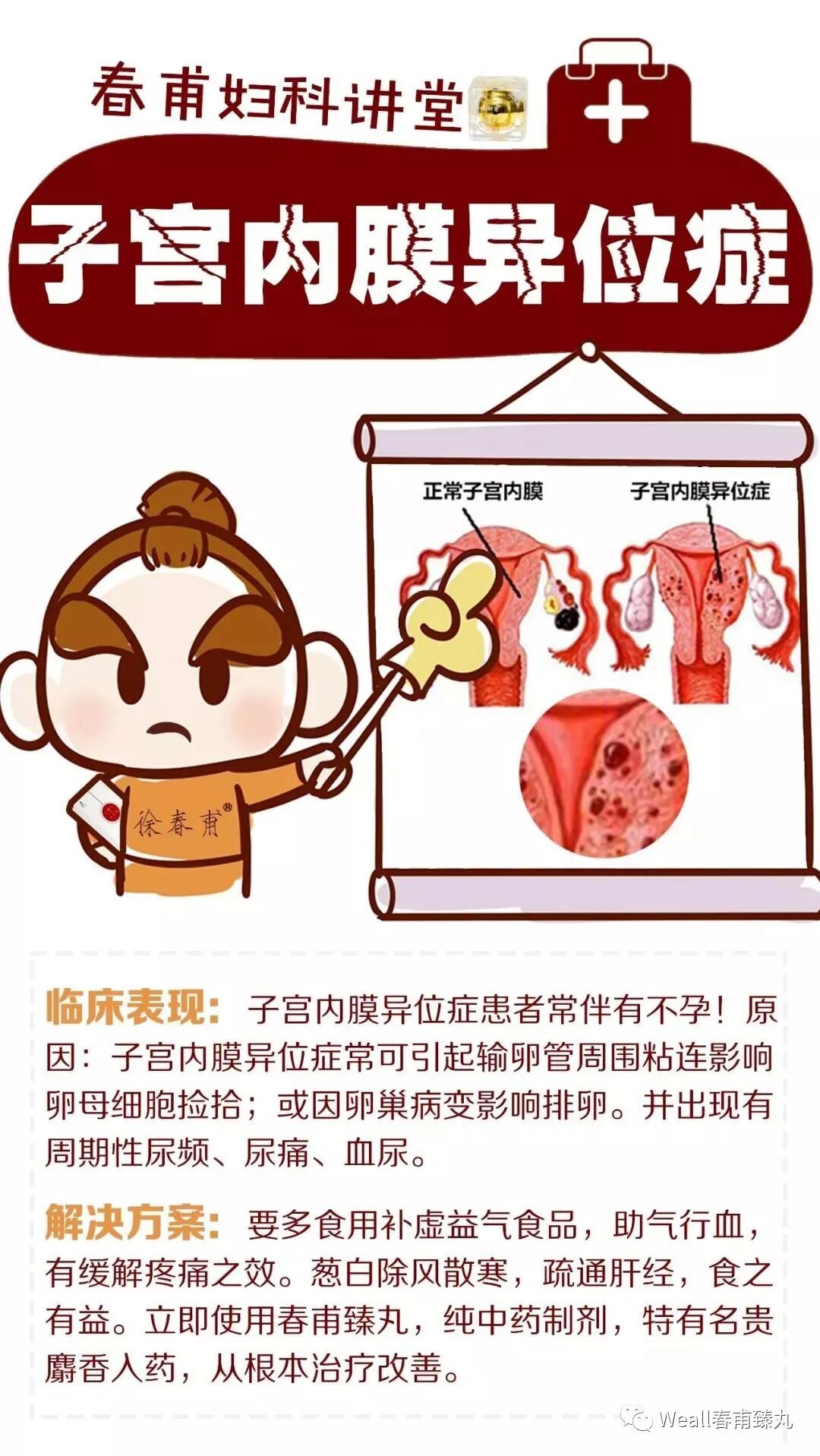 春甫臻丸 子宫内膜异位症 Weall春甫臻丸 微信公众号文章阅读 Wemp