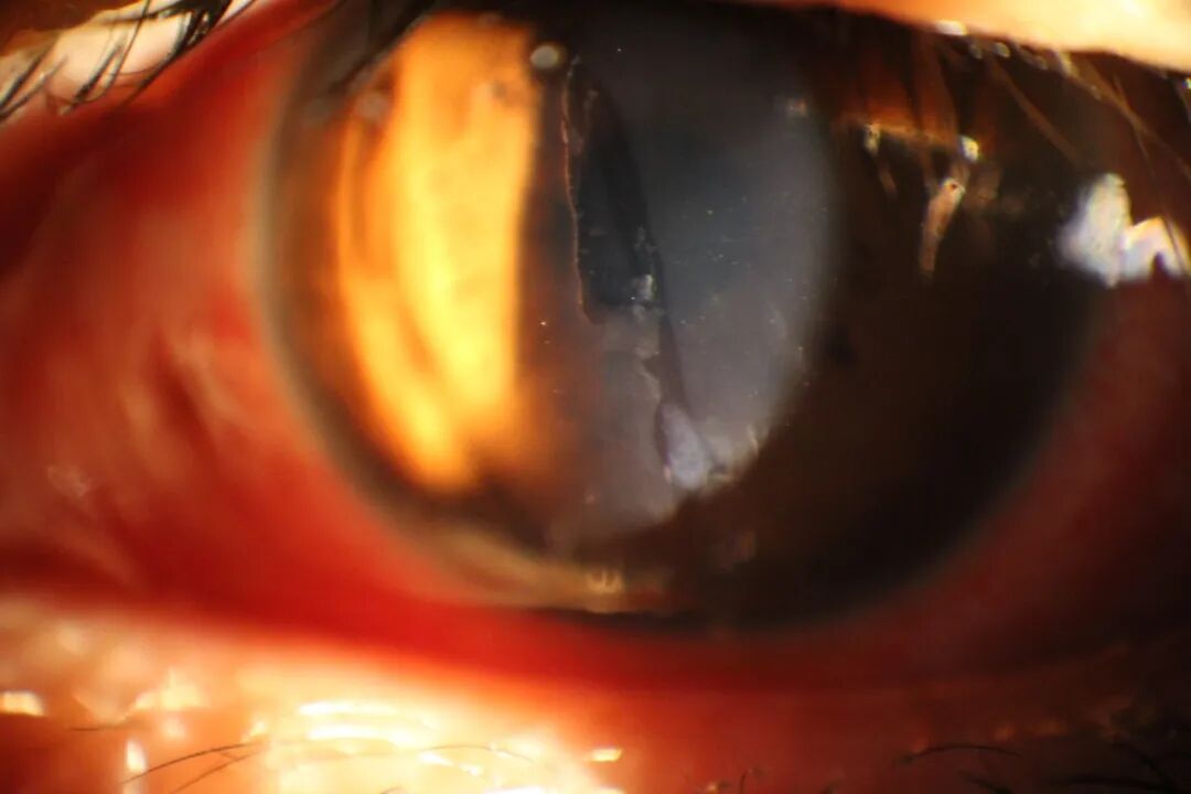 眼前节照相怎么照常见眼前段疾病一览_https://www.jmylbn.com_新闻资讯_第14张