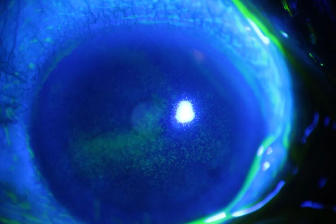 眼前节照相怎么照常见眼前段疾病一览_https://www.jmylbn.com_新闻资讯_第5张