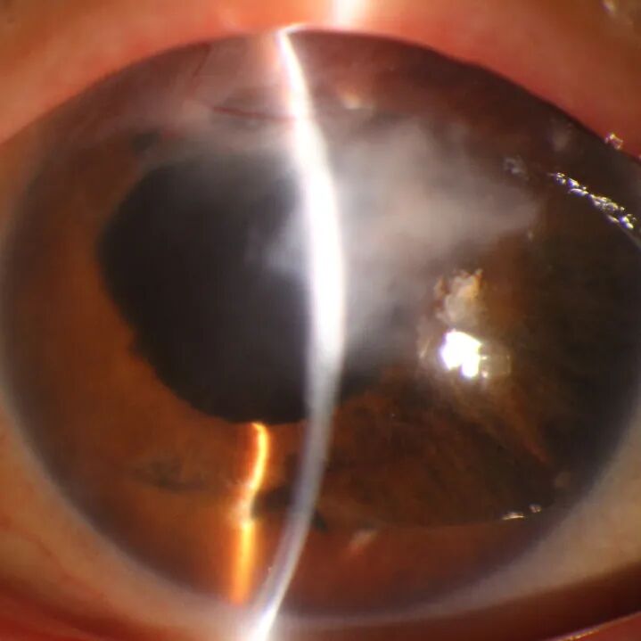 眼前节照相怎么照常见眼前段疾病一览_https://www.jmylbn.com_新闻资讯_第6张