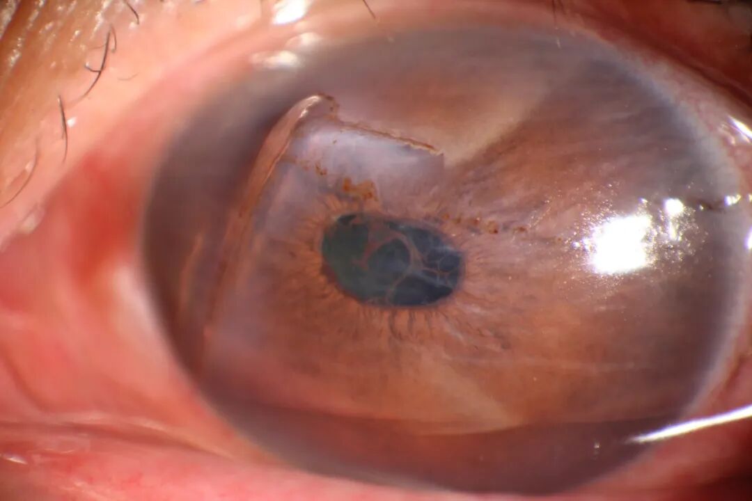 眼前节照相怎么照常见眼前段疾病一览_https://www.jmylbn.com_新闻资讯_第15张