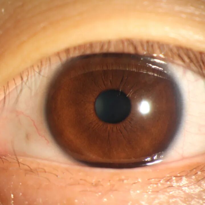 眼前节照相怎么照常见眼前段疾病一览_https://www.jmylbn.com_新闻资讯_第1张