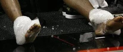 一觉醒来，直接退役！脚踝彻底报废……